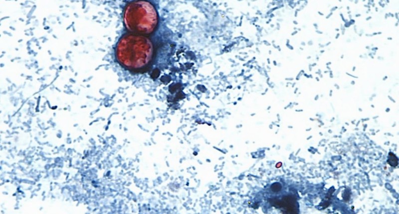 EU REPORTA PRIMERAS DOS MUERTES POR `DIARREA EXPLOSIVA´ A CAUSA DE CYCLOSPORA; SUMAN MÁS DE 4 MIL CASOS CONFIRMADOS